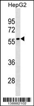 LRRC69 Antibody (Center)