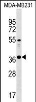 CTRB1 Antibody (Center)