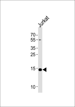 UBE2D4 Antibody (C-term)