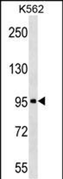 ABI3BP Antibody (Center)