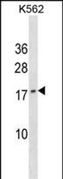 GCHFR Antibody (C-term)
