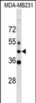 MLC1 Antibody (C-term)