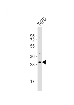 OR10T2 Antibody (C-term)