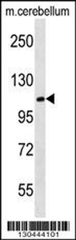 MBD6 Antibody (C-term)
