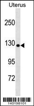 COL19A1 Antibody (N-term)