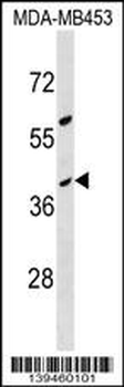 OR10G8 Antibody (C-term)