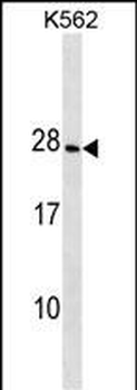 CRYGD Antibody (Center)