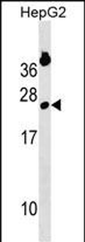 GINS2 Antibody (Center)