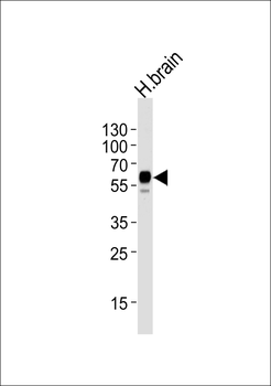 LRRTM2 Antibody (C-term)
