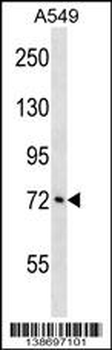 ATXN1L Antibody (Center)