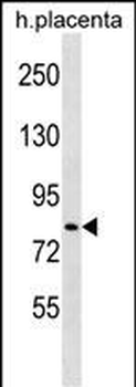 HECTD2 Antibody (N-term)