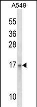 EMP3 Antibody (C-term)