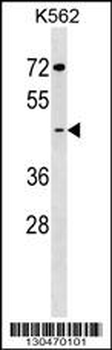 GCNT7 Antibody (C-term)