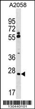 CNPY3 Antibody (N-term)