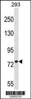 PLK1S1 Antibody (N-term)