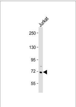 HBS1L Antibody (Center)