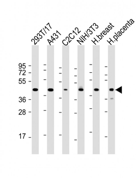 ERLIN2 Antibody (C-term)