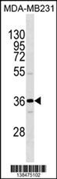 OR1I1 Antibody (N-term)
