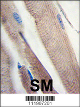 PI3KC3 Antibody (S851)
