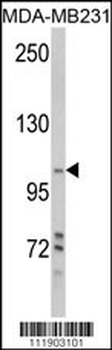 PI3KC3 Antibody (S425)