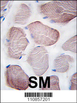 PI3KC3 Antibody (C-term E785)