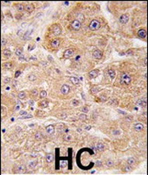UVRAG Antibody (C-term)