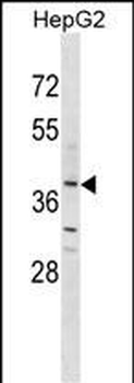OR2K2 Antibody (N-term)