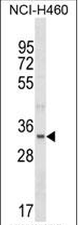 FBLL1 Antibody (Center)