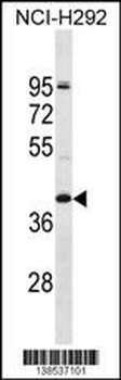 OR2T5 Antibody (N-term)