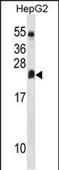 DHRS4L2 Antibody (Center)