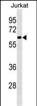 SLU7 Antibody (N-term)
