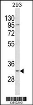 TACO1 Antibody (N-term)