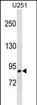 OSBPL10 Antibody (C-term)