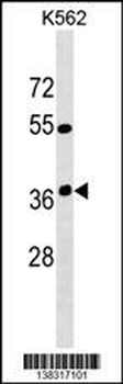 OR12D3 Antibody (C-term)