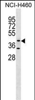 GLT8D1 Antibody (C-term)