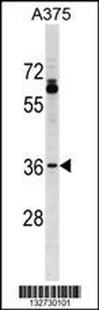 OR51T1 Antibody (C-term)