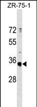 OR51G1 Antibody (C-term)