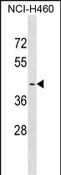 OR2A4 Antibody (N-term)