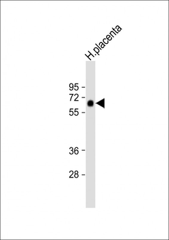 ZFP57 Antibody (Center)