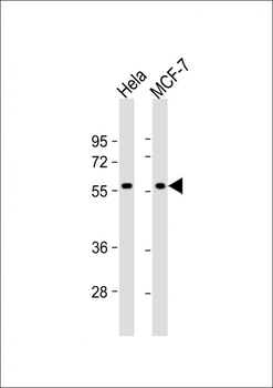 TIGD1 Antibody (N-term)