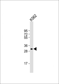 NKX6-2 Antibody (N-term)
