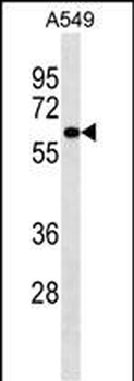 PIGS Antibody (C-term)