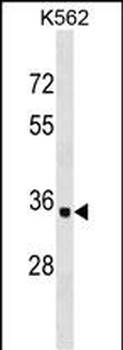 OR10AD1 Antibody (Center)