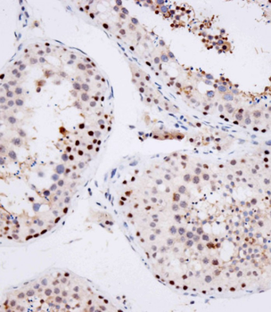 OTUD7A Antibody (N-term)