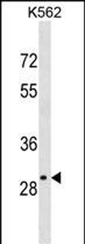 OR4S2 Antibody (C-term)