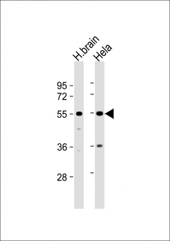 TFG Antibody (Center)