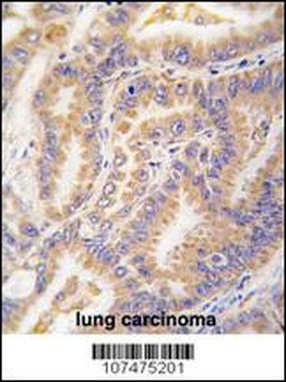 ATG12 Antibody (N-term)