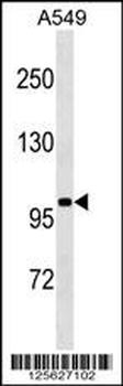 SLN13 Antibody (C-term)