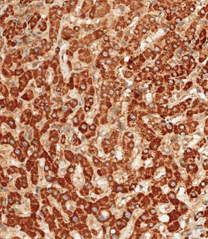 ATG7 Antibody (C-term)