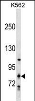 GLT25D2 Antibody (N-term)